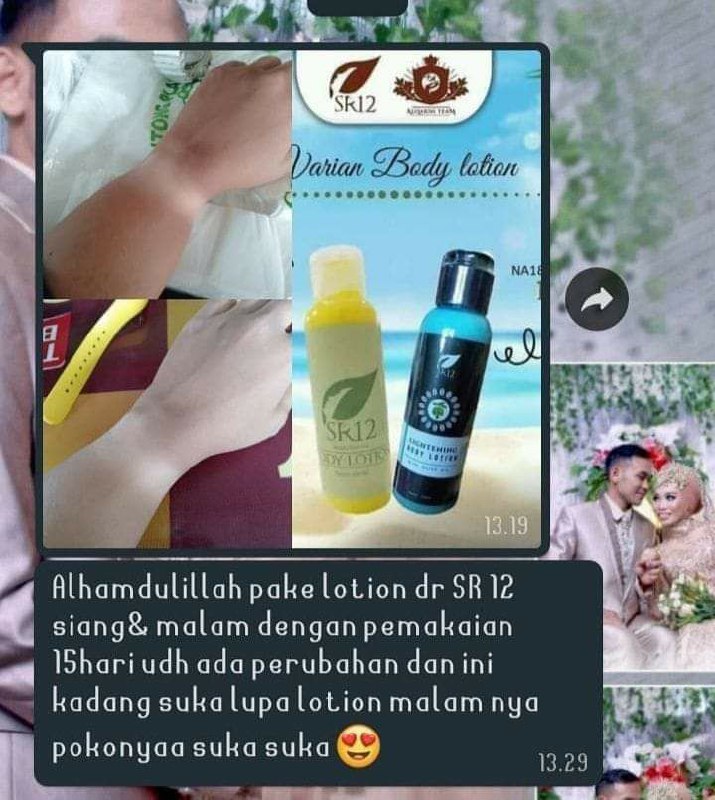 Yang komplit itu insyaAllah hasil nya josss...kayak nasi goreng komplit beda lah rasanya sama yang nasi goreng biasa...tul nggak...???🤗🤩#HandBodySR12Yang suka lupa aja gini hasil nya👍👍👍bagaimana Yang rutin ya...??? 🤔Yuk sayangi dan rawat kulitmu dengan yg alami2 dan herbal ya...dengan SR12 Herbal Skincare,Insyaallah cantik berseri alami tanpa rasa khawatir 🤩🥰Ready stock🤩 🌿 HandBody siang (kemasan baru)🌿 HandBody malam (Kemasan lama dan baru )Order/konsultasi (Free) : WA/telegram 👉0821-5799-8873AGEN RESMI SR12 HERBAL SKINCARE BALIKPAPAN, KALTIM .