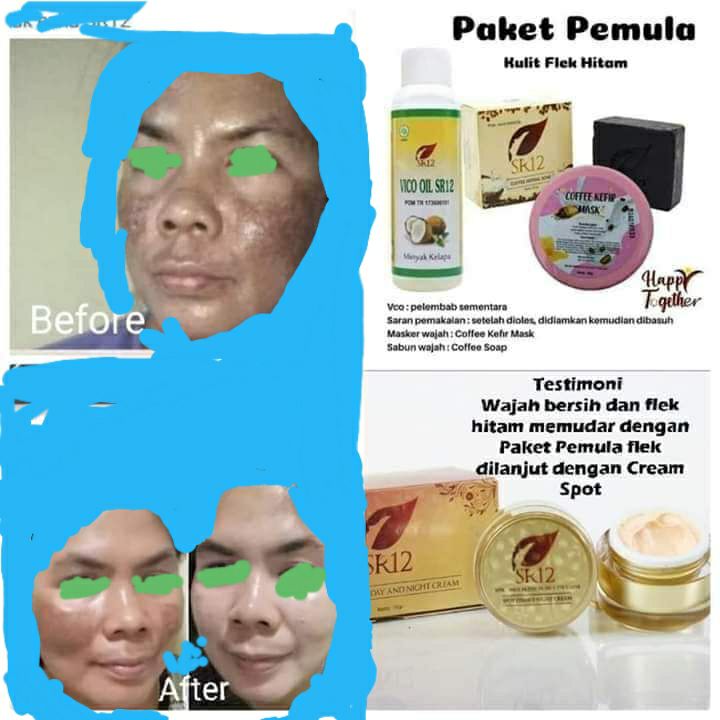 SR12 tidak merubah warna kulitmu, SR12 tidak  menjanjikan kulitmu putih tapi SR12 membuat kulit mu sehat cerah alami.Wajah SR12 itu cerah Alami guysss..., putih nya bukan putih pucat, bukan licin 🤗 nggak ngelupas merah2🤭, wajah SR12 itu wajah Herbal alami, perawatan SR12 HERBAL SKINCARE itu mengembalikan kecantikan alami kulitmu, mengeluarkan racun-racun atau zat2 kimia berbahaya lainnya yg menumpuk di wajahmu, memutus siklus ketergantungan terhadap kosmetik sebelumnya, mencerahkan secara maksimal sesuai warna asli kulit kita.Beauty is not a dream,  Bringing back your beauty 🥰Order atau konsultasi(free):Wa/telegram 👉0821-5799-8873AGEN RESMI SR12 HERBAL SKINCARE BALIKPAPAN, KAL-TIM Insyaallah FAST RESPON 🤩🤩🤩SR12 tidak merubah warna kulitmu, SR12 tidak  menjanjikan kulitmu putih tapi SR12 membuat kulit mu sehat cerah alami.Wajah SR12 itu cerah Alami guysss..., putih nya bukan putih pucat, bukan licin 🤗 nggak ngelupas merah2🤭, wajah SR12 itu wajah Herbal alami, perawatan SR12 HERBAL SKINCARE itu mengembalikan kecantikan alami kulitmu, mengeluarkan racun-racun atau zat2 kimia berbahaya lainnya yg menumpuk di wajahmu, memutus siklus ketergantungan terhadap kosmetik sebelumnya, mencerahkan secara maksimal sesuai warna asli kulit kita.Beauty is not a dream,  Bringing back your beauty 🥰Order atau konsultasi(free):Wa/telegram 👉0821-5799-8873AGEN RESMI SR12 HERBAL SKINCARE BALIKPAPAN, KAL-TIM Insyaallah FAST RESPON 🤩🤩🤩