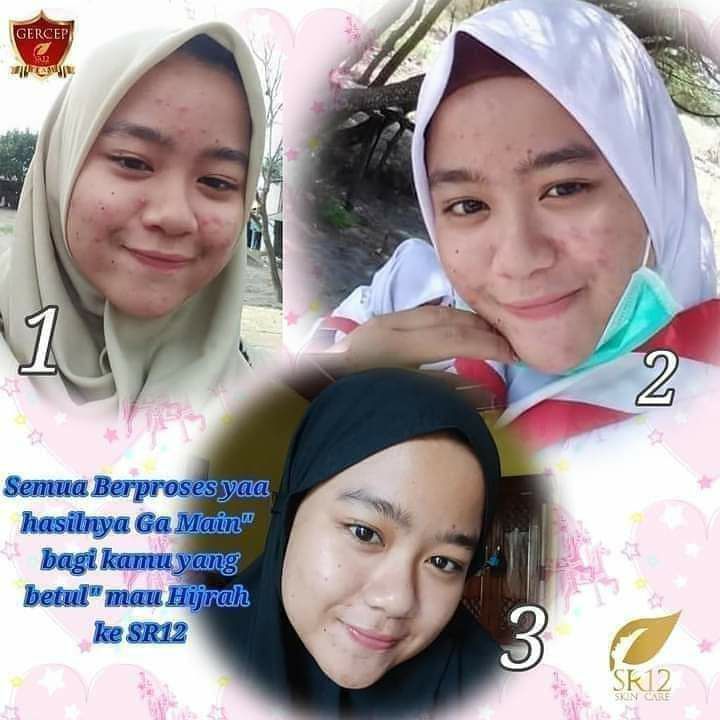 Ini lah salah satu contoh hasil perawatan SR12 Herbal Skincare 👆👆👆Kulit tampak sehat bak kulit bayi, bukan putih pucat licin meloneng bak porcelen ya, bukan licin melene ya🤭😬 Wajah herbal itu adem, sejuk di pandang...🥰 kalau kamu bisa putih dengan perawatan SR12 itu karena pada dasarnya kulit mu emang udah putih ya, tapi kalau asli nya hitam ya tetap aja hitam tapi bersih, cerah alami, lembut lembab sehat bak kulit bayi. Yang penting sabar telaten dan mau berproses.okeyyyy🥰 SR12 Menebar ManfaatBringing Back Your Beauty. Beauty is not a dream 💐💐💐Order/konsultasi (free)WA/Telegram👉0821-5799-8873AGEN RESMI SR12 HERBAL SKINCARE BALIKPAPAN KAL-TIM