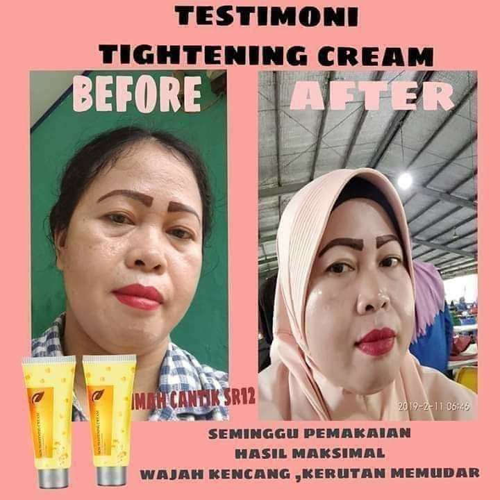 🌸SKIN TIGHTENING CREAMTightening Cream hadir dengan kemasan baru dan mewah