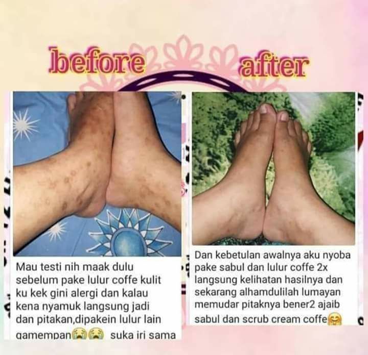 Duet Lulur Scrub Coffee SR12 dan Sabun bulus SR12 (Sabul) 🤩🤩👍👍