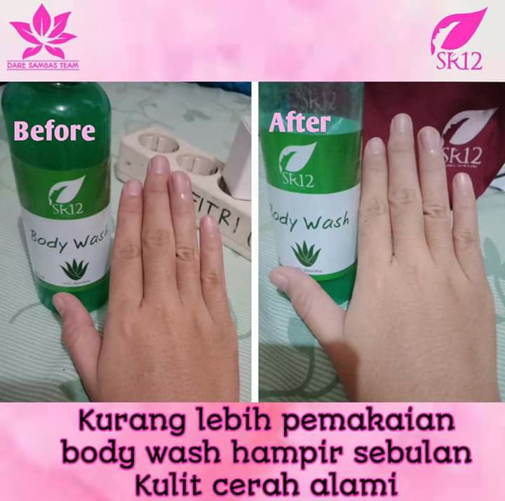 Hayoooo... siapa yang mau mandi berasa luluran..? Cungggg☝️Sabun cair nya SR12 ini  berasa SPA di salon-salon mewah,  di lengkapi butiran scrub yg lembut sehingga daki dan noda pada rontok terangkat, tidak menjanjikan tapi membuktikan bahwa kulit tampak segar, cerah, sehat alami, bening  semriwinggg 🌸🌸🌸🌿🌿🌿Mandi segerrrrrr dengan BodyWash SR12 💦💦💦Yok segera kepoin ya temans.. dan order segera..Stock menipis...🤩🚀🚀 GerceepReady kemasan baru model pump and tubeWA/Telegram 👉 0821-5799-8873AGEN RESMI SR12 HERBAL SKINCARE BALIKPAPAN, KAL-TIMMampir yuk ke tokpedku atau shopeeku 👇tokopedia.com/sr12balikpapanAtaushopee.co.id/agenresmisr12Bisa pakai voucher free ongkir dan bisa COD juga lo... GERCEEP🎉Hayoooo... siapa yang mau mandi berasa luluran..? Cungggg☝️Sabun cair nya SR12 ini  berasa SPA di salon-salon mewah,  di lengkapi butiran scrub yg lembut sehingga daki dan noda pada rontok terangkat, tidak menjanjikan tapi membuktikan bahwa kulit tampak segar, cerah, sehat alami, bening  semriwinggg 🌸🌸🌸🌿🌿🌿Mandi segerrrrrr dengan BodyWash SR12 💦💦💦Yok segera kepoin ya temans.. dan order segera..Stock menipis...🤩🚀🚀 GerceepReady kemasan baru model pump and tubeWA/Telegram 👉 0821-5799-8873AGEN RESMI SR12 HERBAL SKINCARE BALIKPAPAN, KAL-TIMMampir yuk ke tokpedku atau shopeeku 👇tokopedia.com/sr12balikpapanAtaushopee.co.id/agenresmisr12Bisa pakai voucher free ongkir dan bisa COD juga lo... GERCEEP🎉