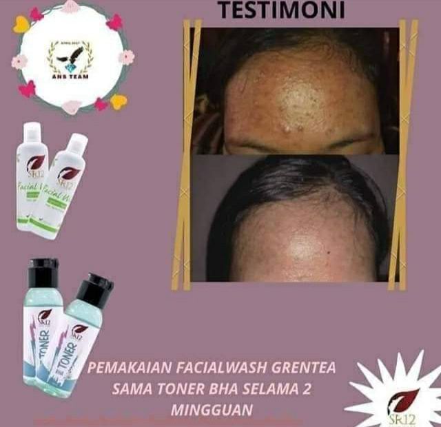 🌿🌸Duet Toner BHA SR12 dan Facial wash green tea SR12, jerawat bruntus hilang, wajahpun semakin cerah alami, bening semriwing🤩Facial wash green tea memang Special buat kulit berminyak dan berjerawat🌸🌿Kemudian Toner BHA SR12 beraksi lagi, kali ini duet bareng sabun Beras SR12Sabun beras cocok untuk kulit berminyak sensitif dan berjerawatReady🌿Toner BHA🌿Rice soap🌿 Facial wash green tea (berminyak-jerawat)🌿 Facial wash green tea(Kering-jerawat)👆Lihatlah wajah SR12, cerah alami kan? Bersih maksimal sampai ke warna asalnya, tidak putih pucat licin melene iya kan? tidak tekupas merah2 iya kan ? Wajah Herbal itu emang adem ngeliatnya🥰yuk segera di order🎉konsultasi (free)WA/telegram👉0821-5799-8873AGEN RESMI SR12 HERBAL SKINCARE BALIKPAPAN KAL-TIMshopee*co*id/agenresmisr12Atautokopedia*com/sr12balikpapan________Utk masuk link toko⤴️ (*) ganti (.)Jangan lewatkan 12.12 di shopee 🥳 voucher/kupon free ongkir Lo, bisa COD juga lo,Kalau di tokpedku bisa pilih pengiriman instan via GO SEND 🎉🎉🌿🌸Duet Toner BHA SR12 dan Facial wash green tea SR12, jerawat bruntus hilang, wajahpun semakin cerah alami, bening semriwing🤩Facial wash green tea memang Special buat kulit berminyak dan berjerawat🌸🌿Kemudian Toner BHA SR12 beraksi lagi, kali ini duet bareng sabun Beras SR12Sabun beras cocok untuk kulit berminyak sensitif dan berjerawatReady🌿Toner BHA🌿Rice soap🌿 Facial wash green tea (berminyak-jerawat)🌿 Facial wash green tea(Kering-jerawat)👆Lihatlah wajah SR12, cerah alami kan? Bersih maksimal sampai ke warna asalnya, tidak putih pucat licin melene iya kan? tidak tekupas merah2 iya kan ? Wajah Herbal itu emang adem ngeliatnya🥰yuk segera di order🎉konsultasi (free)WA/telegram👉0821-5799-8873AGEN RESMI SR12 HERBAL SKINCARE BALIKPAPAN KAL-TIMshopee*co*id/agenresmisr12Atautokopedia*com/sr12balikpapan________Utk masuk link toko⤴️ (*) ganti (.)Jangan lewatkan 12.12 di shopee 🥳 voucher/kupon free ongkir Lo, bisa COD juga lo,Kalau di tokpedku bisa pilih pengiriman instan via GO SEND 🎉🎉