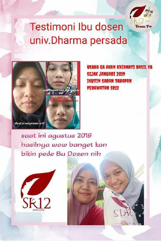 Di SR12 itu Setiap jenis jerawat masing2 punya solusi.sehingga tidak seperti obat jerawat yang lain yang terkadang jerawat and kulit wajah tekupas semua hingga tampak putih pucat, terkadang pula kulit sekitar sudah bersih putih tapi  jerawat masih meninggalkan bekas merah terkadang bekas hitam-hitam No no no insyaAllah di SR12 nggak seperti itu ya, di SR12 kulit wajah akan kembali normal seperti sediakala warna asli kulitmu bahkan  lebih sehat cerah alami🥰🤩😎ORDER/KONSULTASI (Free)Wa/telegram 👉0821-5799-8873AGEN RESMI SR12 HERBAL SKINCARE BALIKPAPAN, KAL-TIMAtau silahkan kunjungi toko online kami di👇shopee.co.id/agenresmisr12Atautokopedia.com/sr12balikpapanDi SR12 itu Setiap jenis jerawat masing2 punya solusi.sehingga tidak seperti obat jerawat yang lain yang terkadang jerawat and kulit wajah tekupas semua hingga tampak putih pucat, terkadang pula kulit sekitar sudah bersih putih tapi  jerawat masih meninggalkan bekas merah terkadang bekas hitam-hitam No no no insyaAllah di SR12 nggak seperti itu ya, di SR12 kulit wajah akan kembali normal seperti sediakala warna asli kulitmu bahkan  lebih sehat cerah alami🥰🤩😎ORDER/KONSULTASI (Free)Wa/telegram 👉0821-5799-8873AGEN RESMI SR12 HERBAL SKINCARE BALIKPAPAN, KAL-TIMAtau silahkan kunjungi toko online kami di👇shopee.co.id/agenresmisr12Atautokopedia.com/sr12balikpapan