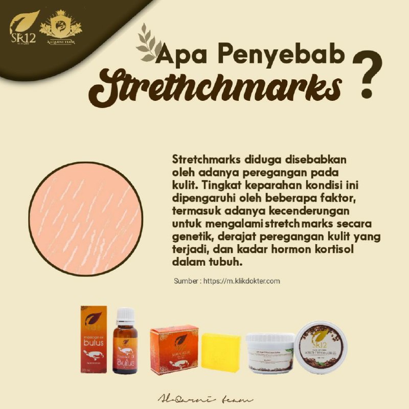 Strethchmark adalah garis-garis di kulit perut yang biasanya muncul pada saat hamil, tapi terkadang juga di bagian lain karena peregangan kulit kemudian setelah melahirkan terkadang masih terlihat dan bahkan makin tampak dengan jelas. Bagi sebagian orang mungkin risih dan malu meski dengan suami sendiri,SR12 Punya solusinya  dengan berbagai produk-produk herbalnya  dan akan lebih mantap lagi kita gandeng dalam satu paket yaitu PAKET STRETHCHMARKS Apa saja isi dalam paket tersebut ?🌿Lulur Scrub Coffee 🌿Sabun bulus 🌿Minyak BulusInsyaAllah paket ini siap menghempaskan strethchmarks yang mengganggu penampilan anda.Oiya paket Stretchmark ini juga bisa mencerahkan sel@ngk@ng hitam lo..Rutin sabar dan telaten ya🤩💪Yuk segera di miliki🎉READY STOCK 🤩🤩🤩WA/telegram 👉0821-5799-8873AGEN RESMI SR12 HERBAL SKINCARE BALIKPAPAN, KAL-TIMIntip-intip shopee ku yuks:shopee.co.id/agenresmisr12Atautokopedia.com/sr12balikpapan