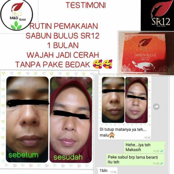 🌿🌸 Sabun Bulus SR12Sabun ajaib  yg manfaat nya luar biasa, bagi yang tau manfaatnya pasti bakal beli lebih dari satu, biasanya minimal 2 atau 4 pcs sekali beli😱Wah ada apa dengan SABUN BULUS SR12?Bukan hanya bikin kulit jadi lembut,  kenyal & kencang juga mampu mencerahkan, memudarkan flek hitam Ada lagi, sabun ini merupakan sabun anti septik yang mampu membunuh *kuman hingga 90% loh*( Virus, bakteri, dan jamur)Sehingga sabun ini juga mampu mengatasi alergi, gatal2, panu dan penyakit kulit lainnya. MasyaAllah, keren kan?READY STOCK💐Tersedia juga yang cair ya, Facial wash Bulus, jadi praktis dibawa kemana-mana.Yok buruan diorder & jadikan sabun antiseptik alami utk keluarga anda.WA/telegram👉0821-5799-8873AGEN RESMI SR12 HERBAL SKINCARE BALIKPAPAN, KAL-TIMMampir ke shopeeku yuks👇shopee.co.id/agenresmisr12Atau tokpedku👇tokopedia.com/sr12balikpapanBisa pakai voucher free ongkir dan bisa COD juga lo GERCEEP🎉🎉🎉🌿🌸 Sabun Bulus SR12Sabun ajaib  yg manfaat nya luar biasa, bagi yang tau manfaatnya pasti bakal beli lebih dari satu, biasanya minimal 2 atau 4 pcs sekali beli😱Wah ada apa dengan SABUN BULUS SR12?Bukan hanya bikin kulit jadi lembut,  kenyal & kencang juga mampu mencerahkan, memudarkan flek hitam Ada lagi, sabun ini merupakan sabun anti septik yang mampu membunuh *kuman hingga 90% loh*( Virus, bakteri, dan jamur)Sehingga sabun ini juga mampu mengatasi alergi, gatal2, panu dan penyakit kulit lainnya. MasyaAllah, keren kan?READY STOCK💐Tersedia juga yang cair ya, Facial wash Bulus, jadi praktis dibawa kemana-mana.Yok buruan diorder & jadikan sabun antiseptik alami utk keluarga anda.WA/telegram👉0821-5799-8873AGEN RESMI SR12 HERBAL SKINCARE BALIKPAPAN, KAL-TIMMampir ke shopeeku yuks👇shopee.co.id/agenresmisr12Atau tokpedku👇tokopedia.com/sr12balikpapanBisa pakai voucher free ongkir dan bisa COD juga lo GERCEEP🎉🎉🎉