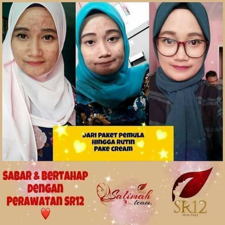 Di SR12 itu Setiap jenis jerawat masing2 punya solusi.sehingga tidak seperti obat jerawat yang lain yang terkadang jerawat and kulit wajah tekupas semua hingga tampak putih pucat, terkadang pula kulit sekitar sudah bersih putih tapi  jerawat masih meninggalkan bekas merah terkadang bekas hitam-hitam No no no insyaAllah di SR12 nggak seperti itu ya, di SR12 kulit wajah akan kembali normal seperti sediakala warna asli kulitmu bahkan  lebih sehat cerah alami🥰🤩😎ORDER/KONSULTASI (Free)Wa/telegram 👉0821-5799-8873AGEN RESMI SR12 HERBAL SKINCARE BALIKPAPAN, KAL-TIMAtau silahkan kunjungi toko online kami di👇shopee.co.id/agenresmisr12Atautokopedia.com/sr12balikpapanDi SR12 itu Setiap jenis jerawat masing2 punya solusi.sehingga tidak seperti obat jerawat yang lain yang terkadang jerawat and kulit wajah tekupas semua hingga tampak putih pucat, terkadang pula kulit sekitar sudah bersih putih tapi  jerawat masih meninggalkan bekas merah terkadang bekas hitam-hitam No no no insyaAllah di SR12 nggak seperti itu ya, di SR12 kulit wajah akan kembali normal seperti sediakala warna asli kulitmu bahkan  lebih sehat cerah alami🥰🤩😎ORDER/KONSULTASI (Free)Wa/telegram 👉0821-5799-8873AGEN RESMI SR12 HERBAL SKINCARE BALIKPAPAN, KAL-TIMAtau silahkan kunjungi toko online kami di👇shopee.co.id/agenresmisr12Atautokopedia.com/sr12balikpapan