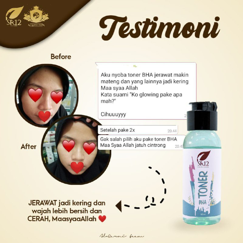 Jerawat makin mateng dan lebih cepat kering dan kempes.Wajah makin Glowing wingg...MaasyaAllaah 🥰🤩#TONER BHA SR12#Toner yang cocok untuk kulit berminyak berjerawat dan ada flek hitam nya.Ready ya...WA/telegram 👉0821-5799-8873AGEN RESMI SR12 HERBAL SKINCARE BALIKPAPAN, KAL-TIM