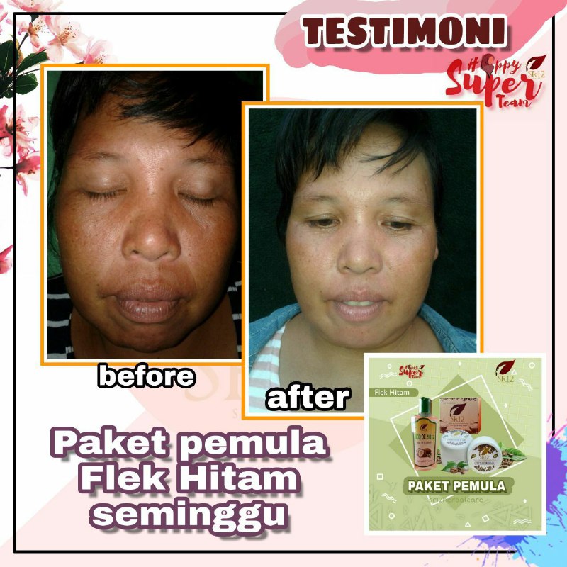 MENGENCANGKAN atau MENCENGANGKAN  ???🤔🤔🤔 ini beberapa 👆BUKTI kalau SR12 itu tidak merubah warna asli kulit kita,  tapi Mencerahkan maksimal sampai ke warna asal kulit kita, cerah sehat ALAMI...guysss ...CANTIK itu tidak harus PUTIH,  tapi Cantik itu haruslah WANITA🙃🤩🤗 wkwkwkw...Yuk hijrah ke perawatan SR12, cantik alami sehat terawat tanpa rasa khawatir bersama SR12 HERBAL SKINCARE,  tersedia berbagai macam solusi sesuai jenis kulit, masalah kulit mu, dan kebutuhan kulit.#PaketPemulaSR12#DuoBulusSR12Order atau konsultasi (free)WA/telegram 👉0821-5799-8873AGEN RESMI SR12 HERBAL SKINCARE BALIKPAPANshopee.co.id/agenresmisr12MENGENCANGKAN atau MENCENGANGKAN  ???🤔🤔🤔 ini beberapa 👆BUKTI kalau SR12 itu tidak merubah warna asli kulit kita,  tapi Mencerahkan maksimal sampai ke warna asal kulit kita, cerah sehat ALAMI...guysss ...CANTIK itu tidak harus PUTIH,  tapi Cantik itu haruslah WANITA🙃🤩🤗 wkwkwkw...Yuk hijrah ke perawatan SR12, cantik alami sehat terawat tanpa rasa khawatir bersama SR12 HERBAL SKINCARE,  tersedia berbagai macam solusi sesuai jenis kulit, masalah kulit mu, dan kebutuhan kulit.#PaketPemulaSR12#DuoBulusSR12Order atau konsultasi (free)WA/telegram 👉0821-5799-8873AGEN RESMI SR12 HERBAL SKINCARE BALIKPAPANshopee.co.id/agenresmisr12