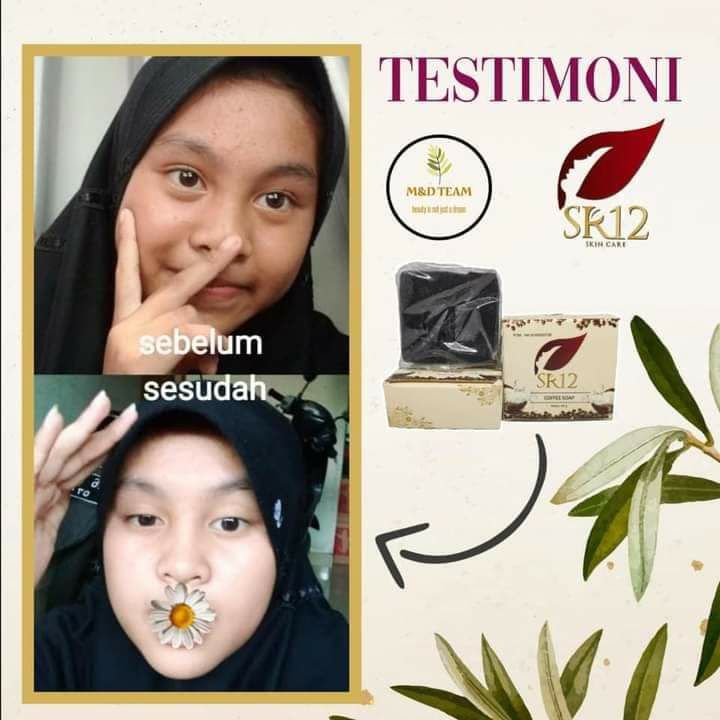 Eh...ada yang bening lo pakai sabun kopi SR12...remaja nggak perlu neko-neko, kulit mu yg masih muda alami nggak usah dimacem-macemin, nggak usah di templokin mercury karena kebelet mau putih instan,  cukup  perawatan alami SR12 aja yuk, tampil bening cerah Alami tanpa rasa khawatir 👍🤩😎🥰Ready STOCK 🤩☕️Coffee Soap SR12☕️ Facial Wash Coffee SR12 Segera hubungi kami:❤️Wa/telegram 👉 0821-5799-8873 AGEN RESMI SR12 HERBAL SKINCARE BALIKPAPAN, KAL-TIM.Mampir yuks ke shopeeku 👇shopee.co.id/agenresmisr12Atau tokpedku👇tokopedia.com/sr12balikpapan