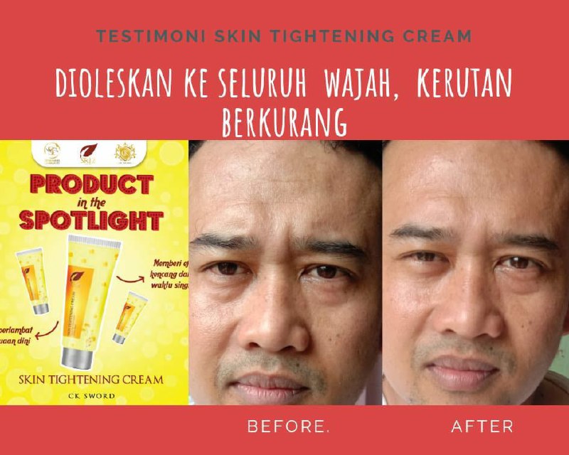 🌸SKIN TIGHTENING CREAMTightening Cream hadir dengan kemasan baru dan mewah