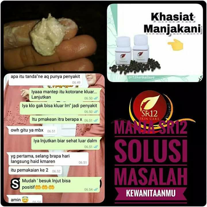 Maaf bukannya jorok ya, tapi kalau yg begini masih bersarang di organ kewanitaan dan nggak segera dikeluarkan dan di atasi, bisa bahaya, karena ini adalah KEPUTIHAN  yng tidak normal.  Jika ini terjadi pada anda, jangan di biarkan dan dianggap remeh, Sebelum merambat kebagian lain dari organ kewanitaan anda, bisa berakibat fatal, bahkan ada yg sampai menganggu sistem reproduksi anda. Juga mengganggu keharmonisan hubungan suami istri🥀segera atasi dengan MANJAKANI SR12. Manjakani SR12 ini 100% HERBAL alami yang diambil dari manjakani asli ACEH dan VCO SR12, sudah banyak yg buktikan khasiat dan keampuhan dari si manja ini. MaasyaAllah🌿Yuk  kepoin dan segera di order dan konsumsi rutin ya sesuai aturan pakainya Konsultasi (free)Ready stock: 🌷Manja butir 🌷Manja Kapsul❤️Wa/telegram 👉0821-5799-8873AGEN RESMI SR12 HERBAL SKINCARE BALIKPAPAN, KAL-TIMshopee.co.id/agenresmisr12Atautokopedia.com/sr12balikpapanBisa pakai voucher free ongkir dan bisa COD juga lo..🎉Maaf bukannya jorok ya, tapi kalau yg begini masih bersarang di organ kewanitaan dan nggak segera dikeluarkan dan di atasi, bisa bahaya, karena ini adalah KEPUTIHAN  yng tidak normal.  Jika ini terjadi pada anda, jangan di biarkan dan dianggap remeh, Sebelum merambat kebagian lain dari organ kewanitaan anda, bisa berakibat fatal, bahkan ada yg sampai menganggu sistem reproduksi anda. Juga mengganggu keharmonisan hubungan suami istri🥀segera atasi dengan MANJAKANI SR12. Manjakani SR12 ini 100% HERBAL alami yang diambil dari manjakani asli ACEH dan VCO SR12, sudah banyak yg buktikan khasiat dan keampuhan dari si manja ini. MaasyaAllah🌿Yuk  kepoin dan segera di order dan konsumsi rutin ya sesuai aturan pakainya Konsultasi (free)Ready stock: 🌷Manja butir 🌷Manja Kapsul❤️Wa/telegram 👉0821-5799-8873AGEN RESMI SR12 HERBAL SKINCARE BALIKPAPAN, KAL-TIMshopee.co.id/agenresmisr12Atautokopedia.com/sr12balikpapanBisa pakai voucher free ongkir dan bisa COD juga lo..🎉