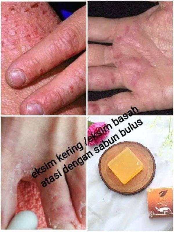 🌿🌸 Sabun Bulus SR12Sabun ajaib  yg manfaat nya luar biasa, bagi yang tau manfaatnya pasti bakal beli lebih dari satu, biasanya minimal 2 atau 4 pcs sekali beli😱Wah ada apa dengan SABUN BULUS SR12?Bukan hanya bikin kulit jadi lembut,  kenyal & kencang juga mampu mencerahkan, memudarkan flek hitam Ada lagi, sabun ini merupakan sabun anti septik yang mampu membunuh *kuman hingga 90% loh*( Virus, bakteri, dan jamur)Sehingga sabun ini juga mampu mengatasi alergi, gatal2, panu dan penyakit kulit lainnya. MasyaAllah, keren kan?READY STOCK💐Tersedia juga yang cair ya, Facial wash Bulus, jadi praktis dibawa kemana-mana.Yok buruan diorder & jadikan sabun antiseptik alami utk keluarga anda.WA/telegram👉0821-5799-8873AGEN RESMI SR12 HERBAL SKINCARE BALIKPAPAN, KAL-TIMMampir ke shopeeku yuks👇shopee.co.id/agenresmisr12Atau tokpedku👇tokopedia.com/sr12balikpapanBisa pakai voucher free ongkir dan bisa COD juga lo GERCEEP🎉🎉🎉🌿🌸 Sabun Bulus SR12Sabun ajaib  yg manfaat nya luar biasa, bagi yang tau manfaatnya pasti bakal beli lebih dari satu, biasanya minimal 2 atau 4 pcs sekali beli😱Wah ada apa dengan SABUN BULUS SR12?Bukan hanya bikin kulit jadi lembut,  kenyal & kencang juga mampu mencerahkan, memudarkan flek hitam Ada lagi, sabun ini merupakan sabun anti septik yang mampu membunuh *kuman hingga 90% loh*( Virus, bakteri, dan jamur)Sehingga sabun ini juga mampu mengatasi alergi, gatal2, panu dan penyakit kulit lainnya. MasyaAllah, keren kan?READY STOCK💐Tersedia juga yang cair ya, Facial wash Bulus, jadi praktis dibawa kemana-mana.Yok buruan diorder & jadikan sabun antiseptik alami utk keluarga anda.WA/telegram👉0821-5799-8873AGEN RESMI SR12 HERBAL SKINCARE BALIKPAPAN, KAL-TIMMampir ke shopeeku yuks👇shopee.co.id/agenresmisr12Atau tokpedku👇tokopedia.com/sr12balikpapanBisa pakai voucher free ongkir dan bisa COD juga lo GERCEEP🎉🎉🎉
