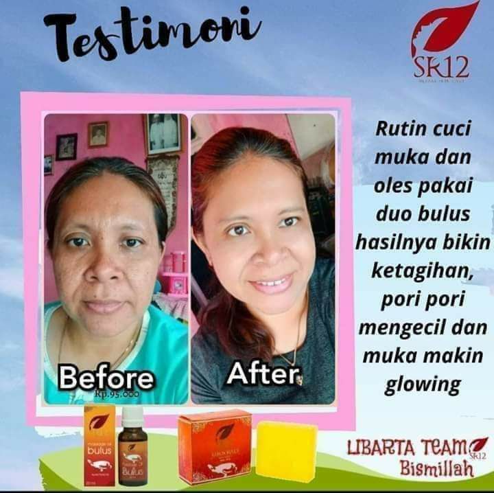 MENGENCANGKAN atau MENCENGANGKAN  ???🤔🤔🤔 ini beberapa 👆BUKTI kalau SR12 itu tidak merubah warna asli kulit kita,  tapi Mencerahkan maksimal sampai ke warna asal kulit kita, cerah sehat ALAMI...guysss ...CANTIK itu tidak harus PUTIH,  tapi Cantik itu haruslah WANITA🙃🤩🤗 wkwkwkw...Yuk hijrah ke perawatan SR12, cantik alami sehat terawat tanpa rasa khawatir bersama SR12 HERBAL SKINCARE,  tersedia berbagai macam solusi sesuai jenis kulit, masalah kulit mu, dan kebutuhan kulit.#PaketPemulaSR12#DuoBulusSR12Order atau konsultasi (free)WA/telegram 👉0821-5799-8873AGEN RESMI SR12 HERBAL SKINCARE BALIKPAPANshopee.co.id/agenresmisr12MENGENCANGKAN atau MENCENGANGKAN  ???🤔🤔🤔 ini beberapa 👆BUKTI kalau SR12 itu tidak merubah warna asli kulit kita,  tapi Mencerahkan maksimal sampai ke warna asal kulit kita, cerah sehat ALAMI...guysss ...CANTIK itu tidak harus PUTIH,  tapi Cantik itu haruslah WANITA🙃🤩🤗 wkwkwkw...Yuk hijrah ke perawatan SR12, cantik alami sehat terawat tanpa rasa khawatir bersama SR12 HERBAL SKINCARE,  tersedia berbagai macam solusi sesuai jenis kulit, masalah kulit mu, dan kebutuhan kulit.#PaketPemulaSR12#DuoBulusSR12Order atau konsultasi (free)WA/telegram 👉0821-5799-8873AGEN RESMI SR12 HERBAL SKINCARE BALIKPAPANshopee.co.id/agenresmisr12