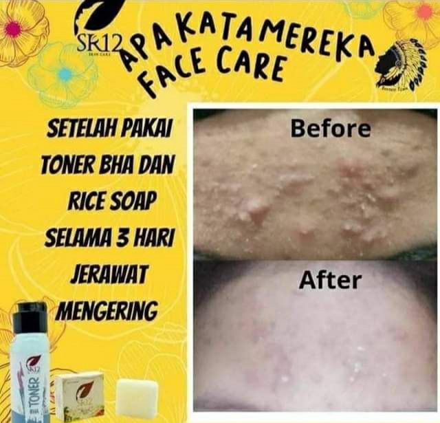 🌿🌸Duet Toner BHA SR12 dan Facial wash green tea SR12, jerawat bruntus hilang, wajahpun semakin cerah alami, bening semriwing🤩Facial wash green tea memang Special buat kulit berminyak dan berjerawat🌸🌿Kemudian Toner BHA SR12 beraksi lagi, kali ini duet bareng sabun Beras SR12Sabun beras cocok untuk kulit berminyak sensitif dan berjerawatReady🌿Toner BHA🌿Rice soap🌿 Facial wash green tea (berminyak-jerawat)🌿 Facial wash green tea(Kering-jerawat)👆Lihatlah wajah SR12, cerah alami kan? Bersih maksimal sampai ke warna asalnya, tidak putih pucat licin melene iya kan? tidak tekupas merah2 iya kan ? Wajah Herbal itu emang adem ngeliatnya🥰yuk segera di order🎉konsultasi (free)WA/telegram👉0821-5799-8873AGEN RESMI SR12 HERBAL SKINCARE BALIKPAPAN KAL-TIMshopee*co*id/agenresmisr12Atautokopedia*com/sr12balikpapan________Utk masuk link toko⤴️ (*) ganti (.)Jangan lewatkan 12.12 di shopee 🥳 voucher/kupon free ongkir Lo, bisa COD juga lo,Kalau di tokpedku bisa pilih pengiriman instan via GO SEND 🎉🎉🌿🌸Duet Toner BHA SR12 dan Facial wash green tea SR12, jerawat bruntus hilang, wajahpun semakin cerah alami, bening semriwing🤩Facial wash green tea memang Special buat kulit berminyak dan berjerawat🌸🌿Kemudian Toner BHA SR12 beraksi lagi, kali ini duet bareng sabun Beras SR12Sabun beras cocok untuk kulit berminyak sensitif dan berjerawatReady🌿Toner BHA🌿Rice soap🌿 Facial wash green tea (berminyak-jerawat)🌿 Facial wash green tea(Kering-jerawat)👆Lihatlah wajah SR12, cerah alami kan? Bersih maksimal sampai ke warna asalnya, tidak putih pucat licin melene iya kan? tidak tekupas merah2 iya kan ? Wajah Herbal itu emang adem ngeliatnya🥰yuk segera di order🎉konsultasi (free)WA/telegram👉0821-5799-8873AGEN RESMI SR12 HERBAL SKINCARE BALIKPAPAN KAL-TIMshopee*co*id/agenresmisr12Atautokopedia*com/sr12balikpapan________Utk masuk link toko⤴️ (*) ganti (.)Jangan lewatkan 12.12 di shopee 🥳 voucher/kupon free ongkir Lo, bisa COD juga lo,Kalau di tokpedku bisa pilih pengiriman instan via GO SEND 🎉🎉