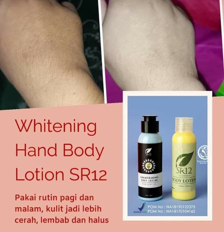 ini tu CERAH maksimal lo pemirsa ....bukan putih bikin bergidik kayak mayit😬🤗😅HandBody SR12 bukan mengubah warna ASLI kulit mu...tapi mencerahkan sampai tingkat kecerahan Asli kulit mu.mau kulit bersih sehat cerah maksimal??gunakan HandBody SR12 HERBAL SKINCARE ya....aman sehat terbukti khasiatnya. dan yg paling penting SUDAH BPOM🤩🤩🤩#HandBodySR12HerbalSkincare#Mencerahkan_secara_maksimal#Kulit_sehat_cerah_alamiOrder/pemesanan silahkan WA/Telegram  ke 👉0821-5799-8873AGEN RESMI SR12 HERBAL SKINCARE BALIKPAPAN