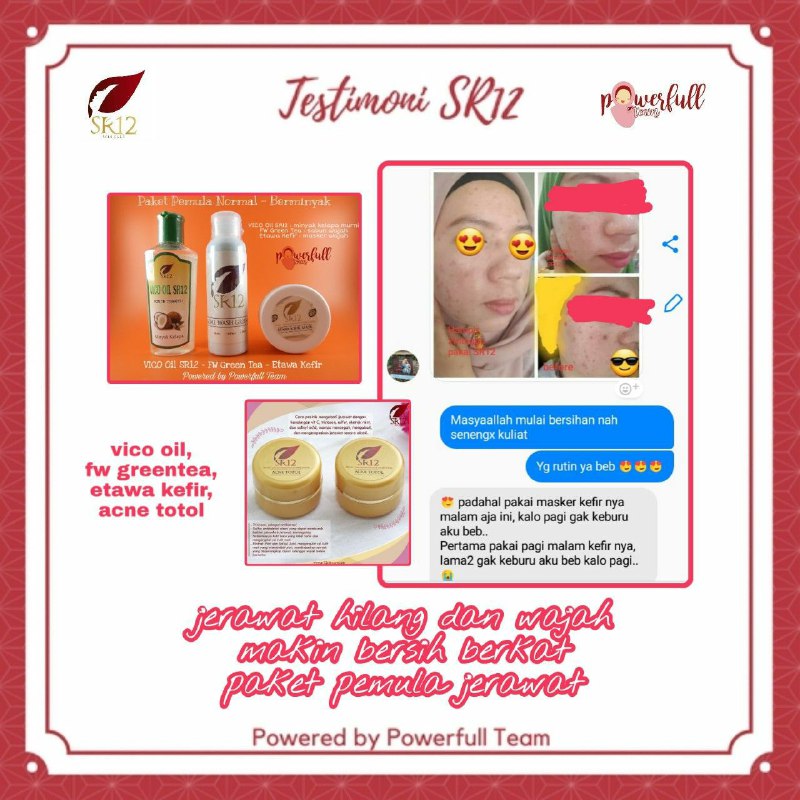 #acnetotol#1kalipakejerawatlangsungkempes#acnetotol#1kalipakejerawatlangsungkempes