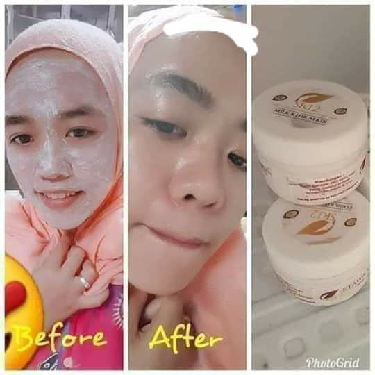 🌿🍯MASKER KEFIR SR12🥛🌿Masker kefir yang bikin wajahmu sehat and cerah, mmbantu eksfloliasi ya, pngangkatan sel kulit mati shingga kusam dan flek hitam minggat.ingat rutin ya.Masker ini juga brfungsi mngeluarkn racun yg numpuk di wajah, memutus siklus ktergantungan trhadap kosmetik sebelumx, putus hubungan dgn mercury/hidroquinon/pemutih instan brbahaya lainnya.kalau saya pertama pakai ini tiap hari bahkan 2 kali sehari pagi &malam. tapi skarang ketika udah cerahan, 2 hari sekali tiap pagi, yg penting ada maskeran dalam seminggu, hee🤗kulit mati/komedo terangkat tanpa rasa sakit lo, lembab lembut kenyal aja ni wajah.Oiya masker kefir ini ada 3 varian pnggunaannya disesuaikan jenis kulit masing2 ya.skarang kemasanx warna pink ya, khasiat n kualitasnya tetap sama2 ampuhx MANTUL.yg penting rutin ikutin petunjuk/aturan pakainya, oke🥰Ready🤩Order/konsultasi (free):WA/telegram👉 0821-5799-8873AGEN RESMI SR12 HERBAL SKINCARE BALIKPAPAN, KAL-TIM🌿🍯MASKER KEFIR SR12🥛🌿Masker kefir yang bikin wajahmu sehat and cerah, mmbantu eksfloliasi ya, pngangkatan sel kulit mati shingga kusam dan flek hitam minggat.ingat rutin ya.Masker ini juga brfungsi mngeluarkn racun yg numpuk di wajah, memutus siklus ktergantungan trhadap kosmetik sebelumx, putus hubungan dgn mercury/hidroquinon/pemutih instan brbahaya lainnya.kalau saya pertama pakai ini tiap hari bahkan 2 kali sehari pagi &malam. tapi skarang ketika udah cerahan, 2 hari sekali tiap pagi, yg penting ada maskeran dalam seminggu, hee🤗kulit mati/komedo terangkat tanpa rasa sakit lo, lembab lembut kenyal aja ni wajah.Oiya masker kefir ini ada 3 varian pnggunaannya disesuaikan jenis kulit masing2 ya.skarang kemasanx warna pink ya, khasiat n kualitasnya tetap sama2 ampuhx MANTUL.yg penting rutin ikutin petunjuk/aturan pakainya, oke🥰Ready🤩Order/konsultasi (free):WA/telegram👉 0821-5799-8873AGEN RESMI SR12 HERBAL SKINCARE BALIKPAPAN, KAL-TIM